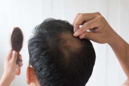 Various causes and reasons for hair loss