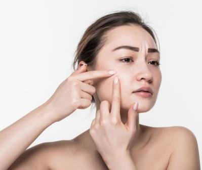 Why pay so much attention to the causes of acne