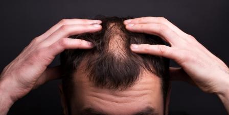 8 Easy Ways To Increase Hair Density - Drug Research