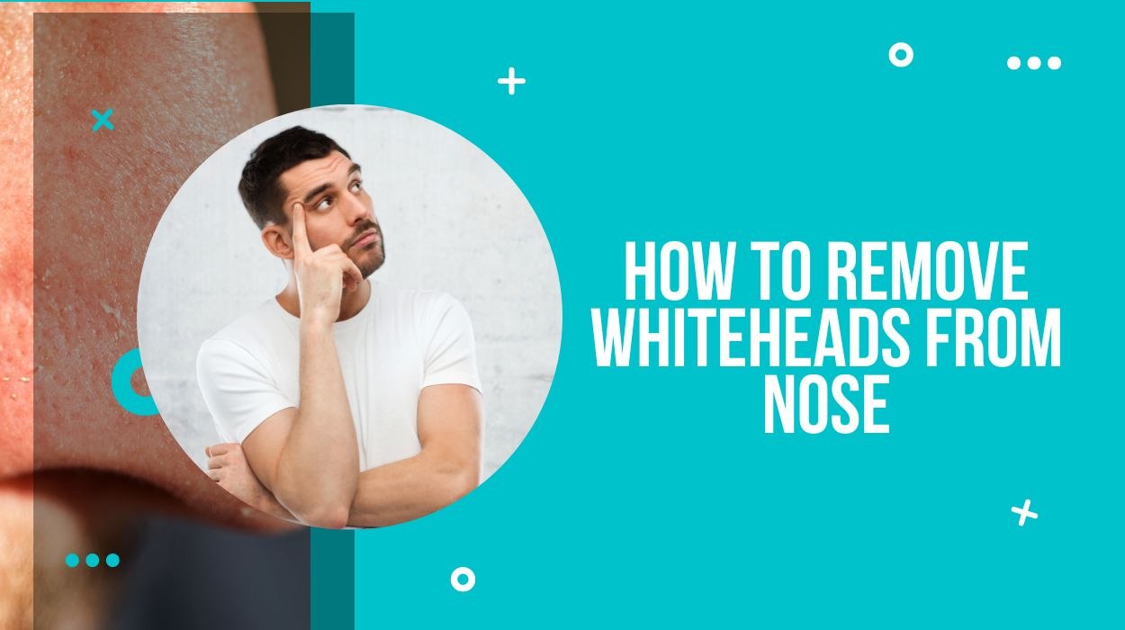 How to Remove Whiteheads from Nose