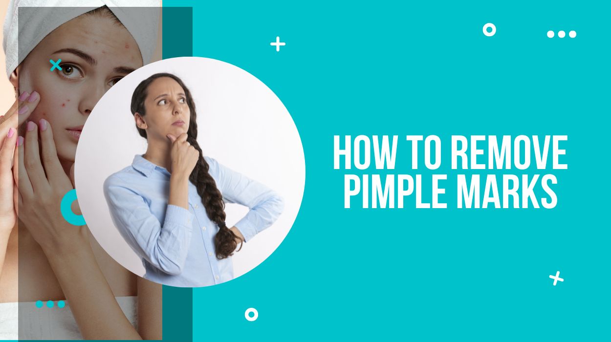 How To Remove Pimple Marks