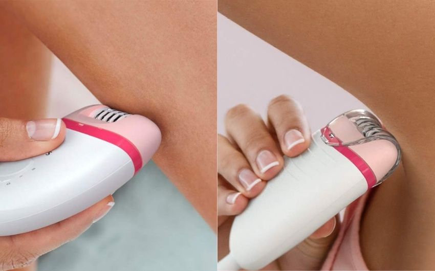 What Is Epilation And How Does It Work? - Drug Research