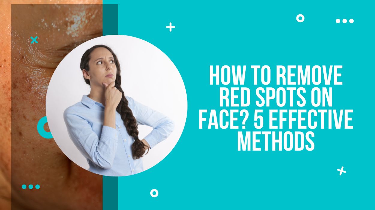 How To Remove Red Spots On Face? 5 Effective Methods