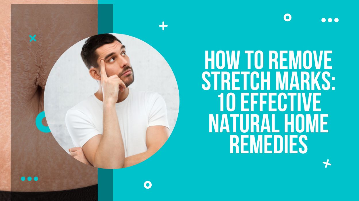 How To Remove Stretch Marks: 10 Effective Natural Home Remedies