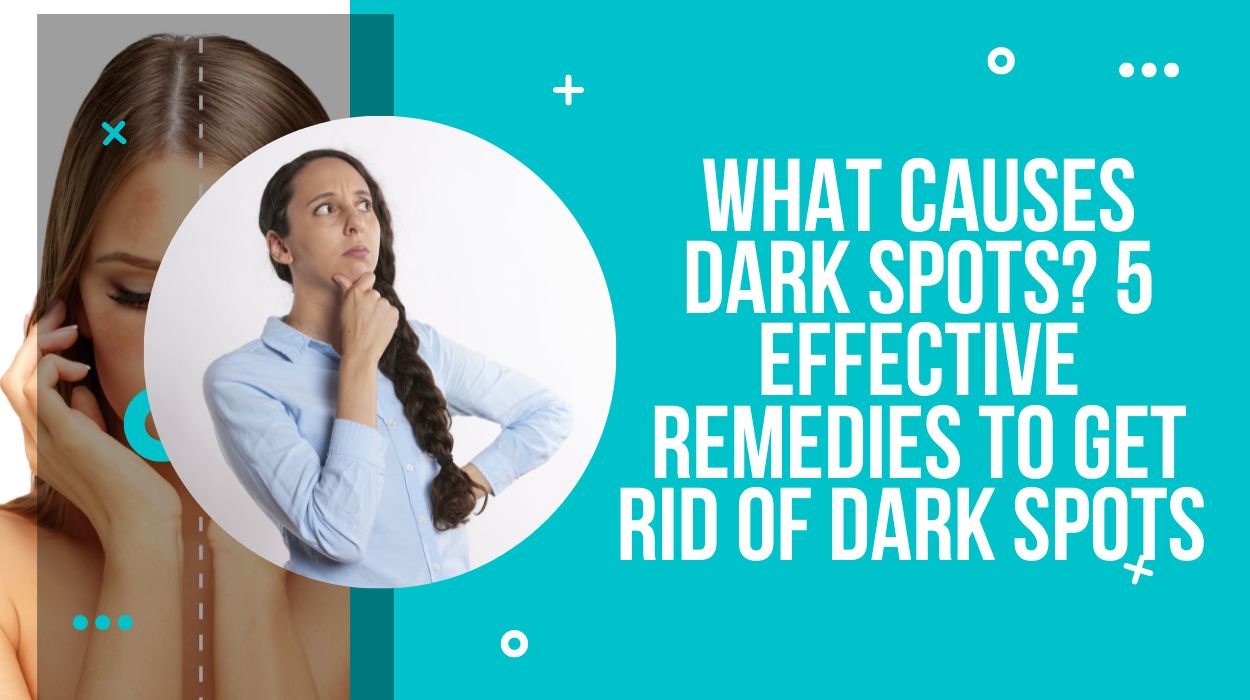 What Causes Dark Spots? 5 Effective Remedies To Get Rid Of Dark Spots 
