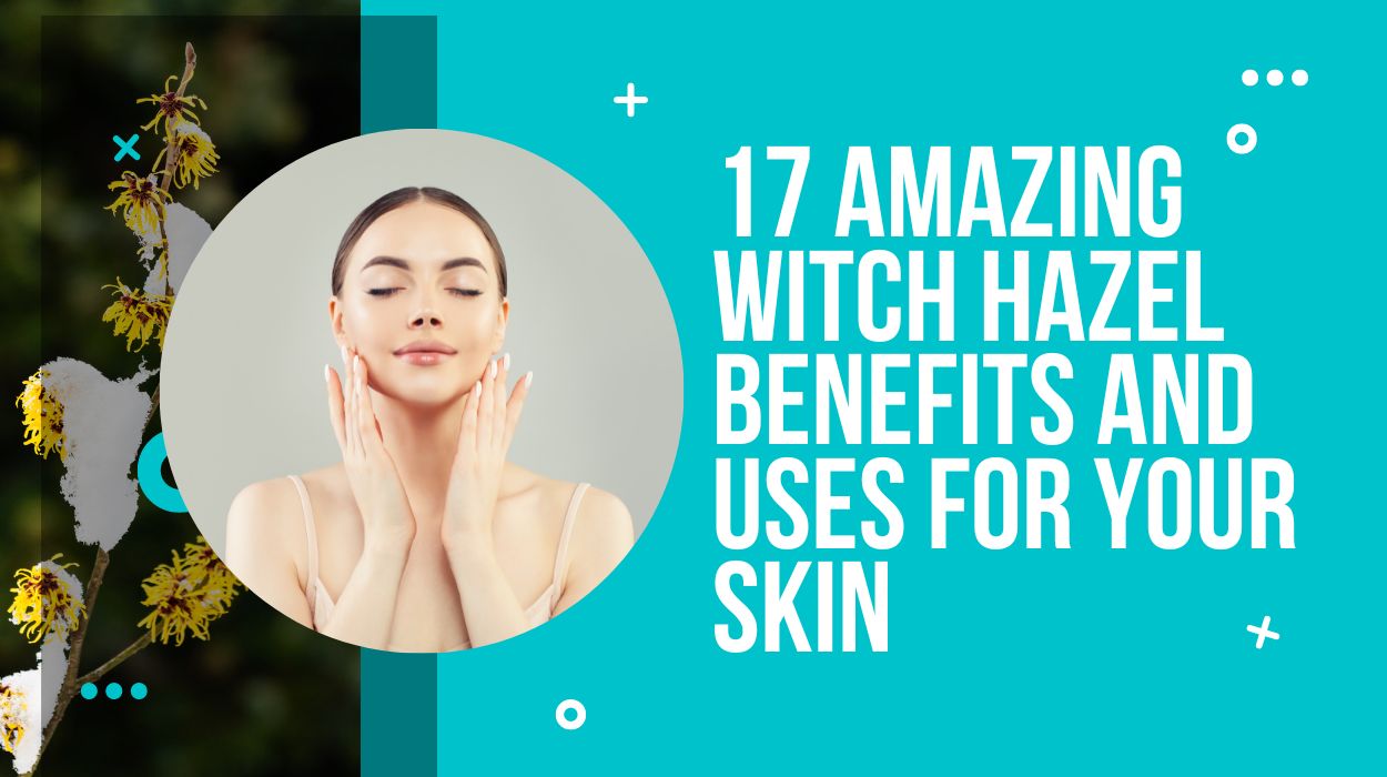 17 Amazing Witch Hazel Benefits And Uses For Your Skin
