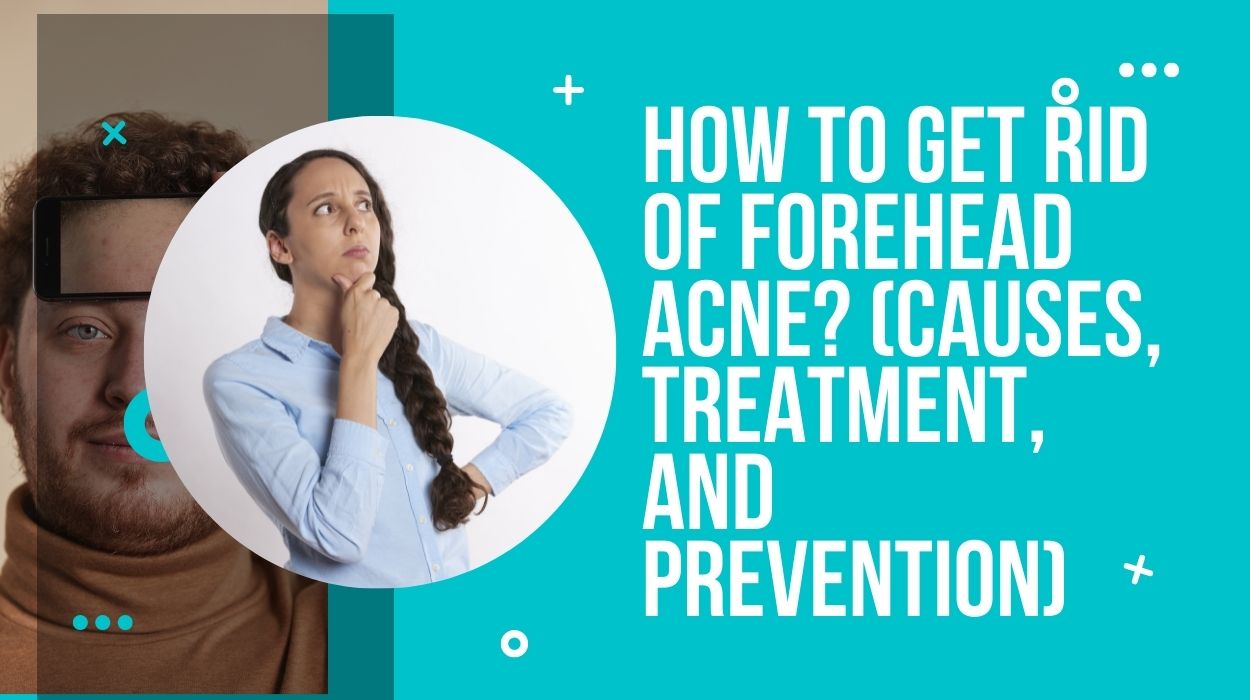 How To Get Rid Of Forehead Acne? (Causes, Treatment, And Prevention)