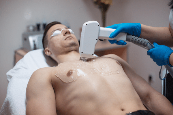 How to get Laser hair removal treatment 
