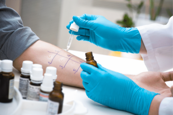 How much does an allergy test cost 