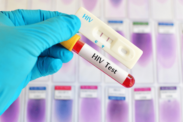 What is the cost of an HIV test