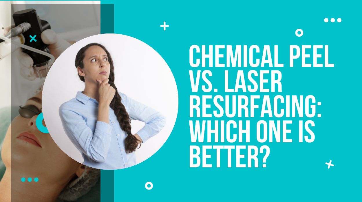 Chemical Peel Vs. Laser Resurfacing: Which One Is Better?